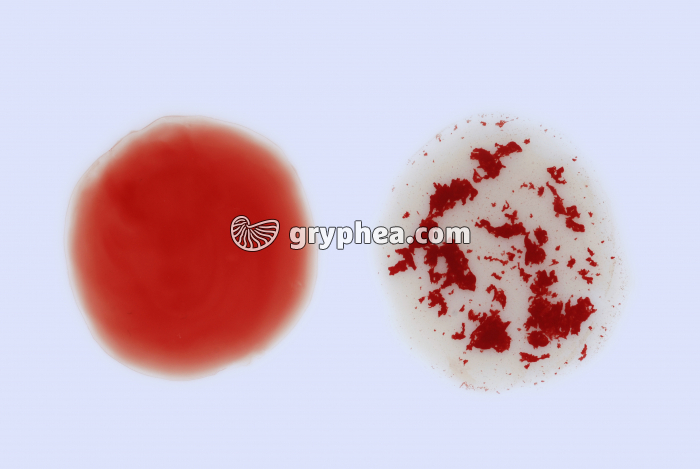 Réaction d'agglutination des hématies - gryphea.com